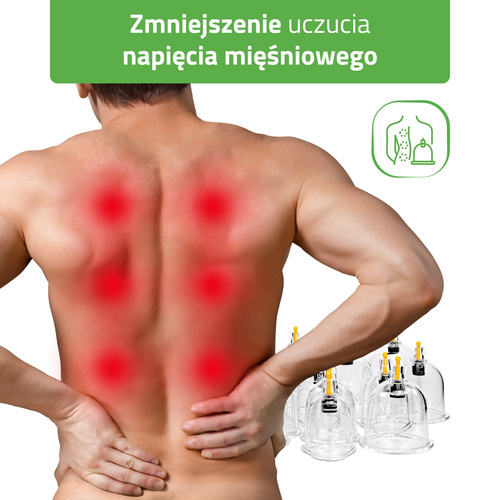 Bańki próżniowe chińskie bezogniowe z pompką 14 szt. | HABYS