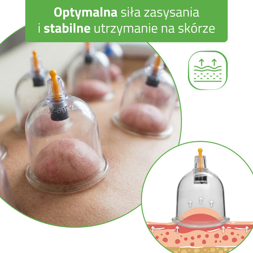 Bańki próżniowe chińskie bezogniowe z pompką 24 szt. | HABYS